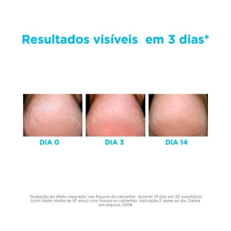 Hidratante para os Pés Isdin Foot Care Ureadin Podos Gel 80,25g