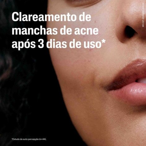 Sérum Tripla-Ação Facial Cetaphil Oil Control Controle de Oleisidade 30ml