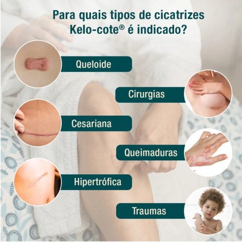 Kelo-Cote Gel de Silicone para Cicatrizes 15g