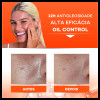 Actine Control Gel Limpeza 140G