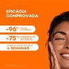 Sabonete Dermatológico em Barra Darrow Actine 70g Sabonete Dermatológico em Barra Darrow Actine 70g