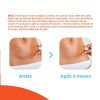 Curat Cremer Silic Cicatr 4Un