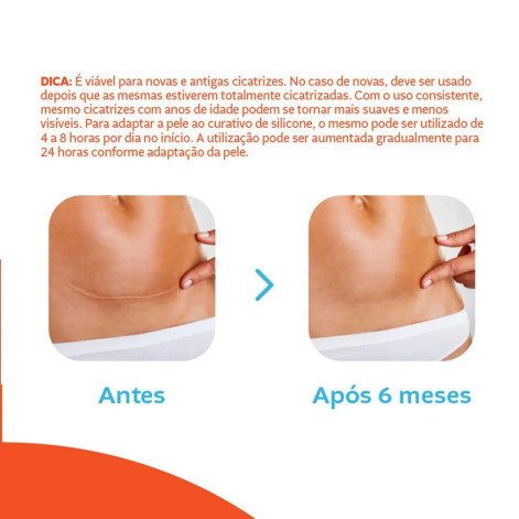 Curat Cremer Silic Cicatr 4Un
