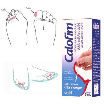 Calofim Para Calos E Verrugas 5ml Adulto E Pediatrico