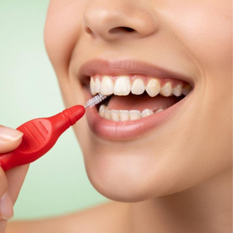 Mini Escova Interdental Kess Cabeça Cilíndrica Extrafina - Ø 3mm 6un Cód. 2005 Mini Escova Interdental Kess Cabeça Cilíndrica Extrafina - Ø 3mm 6un Cód. 2005