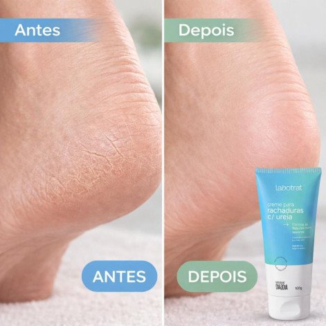 Creme para Rachaduras com Ureia Labotrat Dia a Dia 100g
