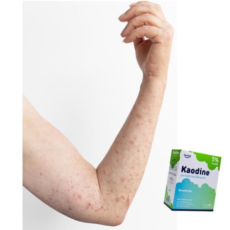 Kaodine Permetrina 50mg/ml Uso Tópico Geolab 60ml