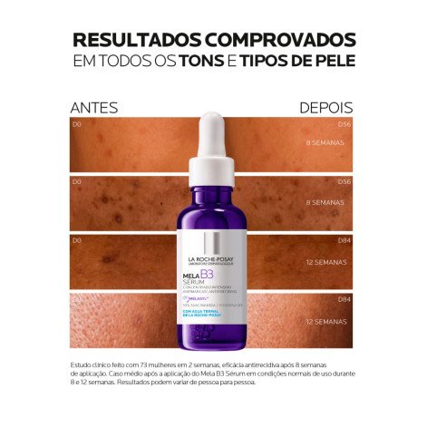 Sérum Facial Antimanchas La Roche-Posay Mela B3 30ml