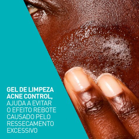 Gel Limpeza Cerave Acne Control 340G