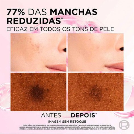 Sérum Facial Anti-Marcas L'oréal Paris Glycolic Bright 30ml
