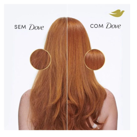 Condicionador Dove Hidratação + Hialuron-VIT 190ml